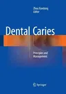 Dental Caries: Principles and Management (Softcover Reprint of the Original 1st 2016)