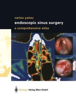 Endoscopic Sinus Surgery: A Comprehensive Atlas (Softcover Reprint of the Original 1st 2003)