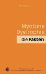 Myotone Dystrophie: Die Fakten