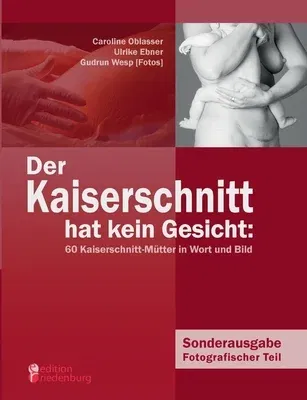 Der Kaiserschnitt hat kein Gesicht: 60 Kaiserschnitt-Mütter in Wort und Bild