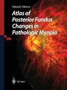 Atlas of Posterior Fundus Changes in Pathologic Myopia (Softcover Reprint of the Original 1st 1998)