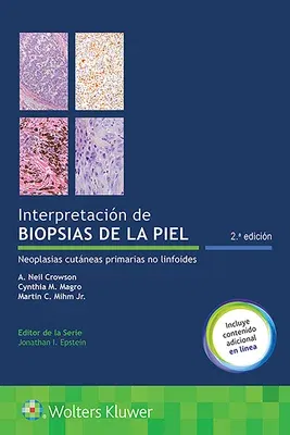 Interpretación de Biopsias de la Piel: Neoplasias Cutáneas Primarias No Linfoides