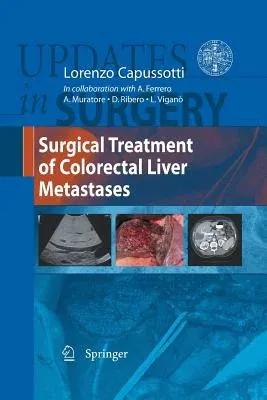 Surgical Treatment of Colorectal Liver Metastases (2011)