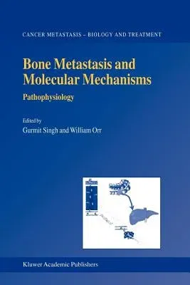 Bone Metastasis and Molecular Mechanisms: Pathophysiology