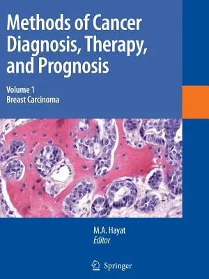 Methods of Cancer Diagnosis, Therapy and Prognosis: Breast Carcinoma