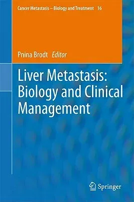 Liver Metastasis: Biology and Clinical Management