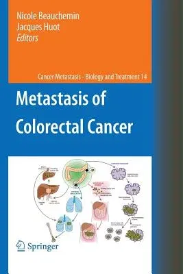 Metastasis of Colorectal Cancer (2010)