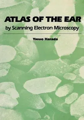 Atlas of the Ear: By Scanning Electron Microscopy (Softcover Reprint of the Original 1st 1983)