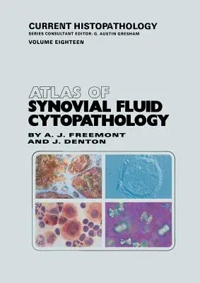 Atlas of Synovial Fluid Cytopathology (Softcover Reprint of the Original 1st 1991)