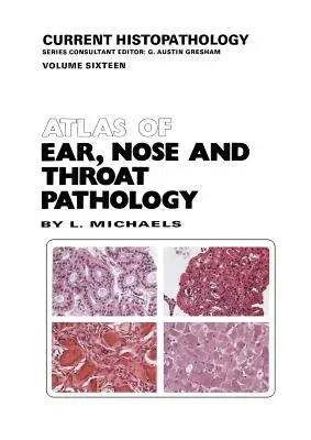 Atlas of Ear, Nose and Throat Pathology (Softcover Reprint of the Original 1st 1990)