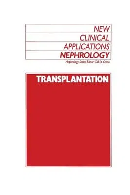 Transplantation (Softcover Reprint of the Original 1st 1989)