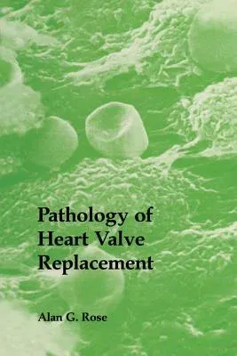 Pathology of Heart Valve Replacement (Softcover Reprint of the Original 1st 1987)