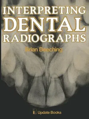 Interpreting Dental Radiographs (Softcover Reprint of the Original 1st 1981)