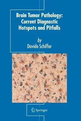 Brain Tumor Pathology: Current Diagnostic Hotspots and Pitfalls (2006)